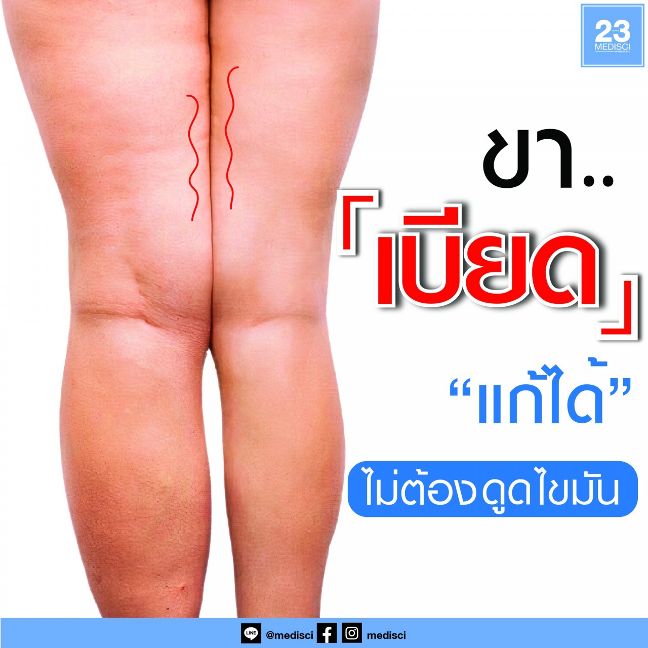 Medisci Anti-Aging - ขาเบียด แก้ได้ ไม่ต้องดูดไขมัน